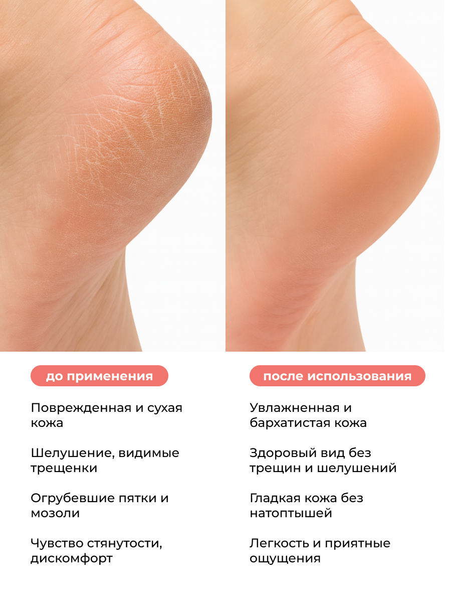 Manita Professional Крем для ног с мочевиной 12%, 250 мл