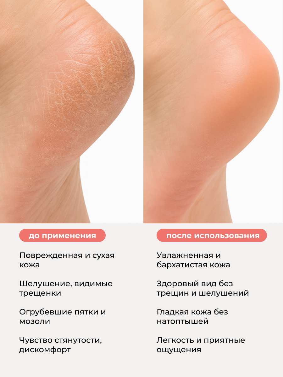 Manita Professional Крем для ног с мочевиной 12%, 500 мл 