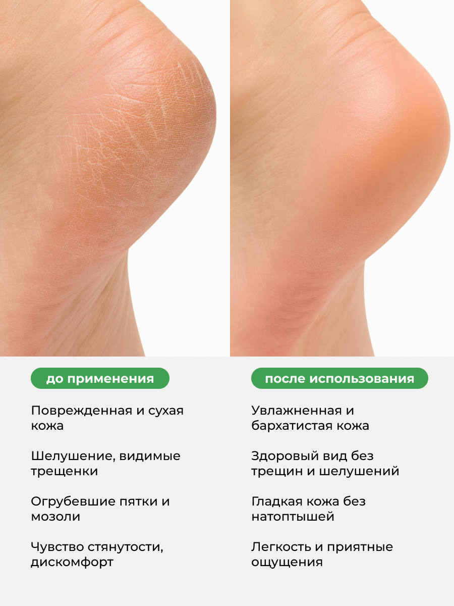 Manita Professional Крем для ног с ментолом и камфорой, 500 мл