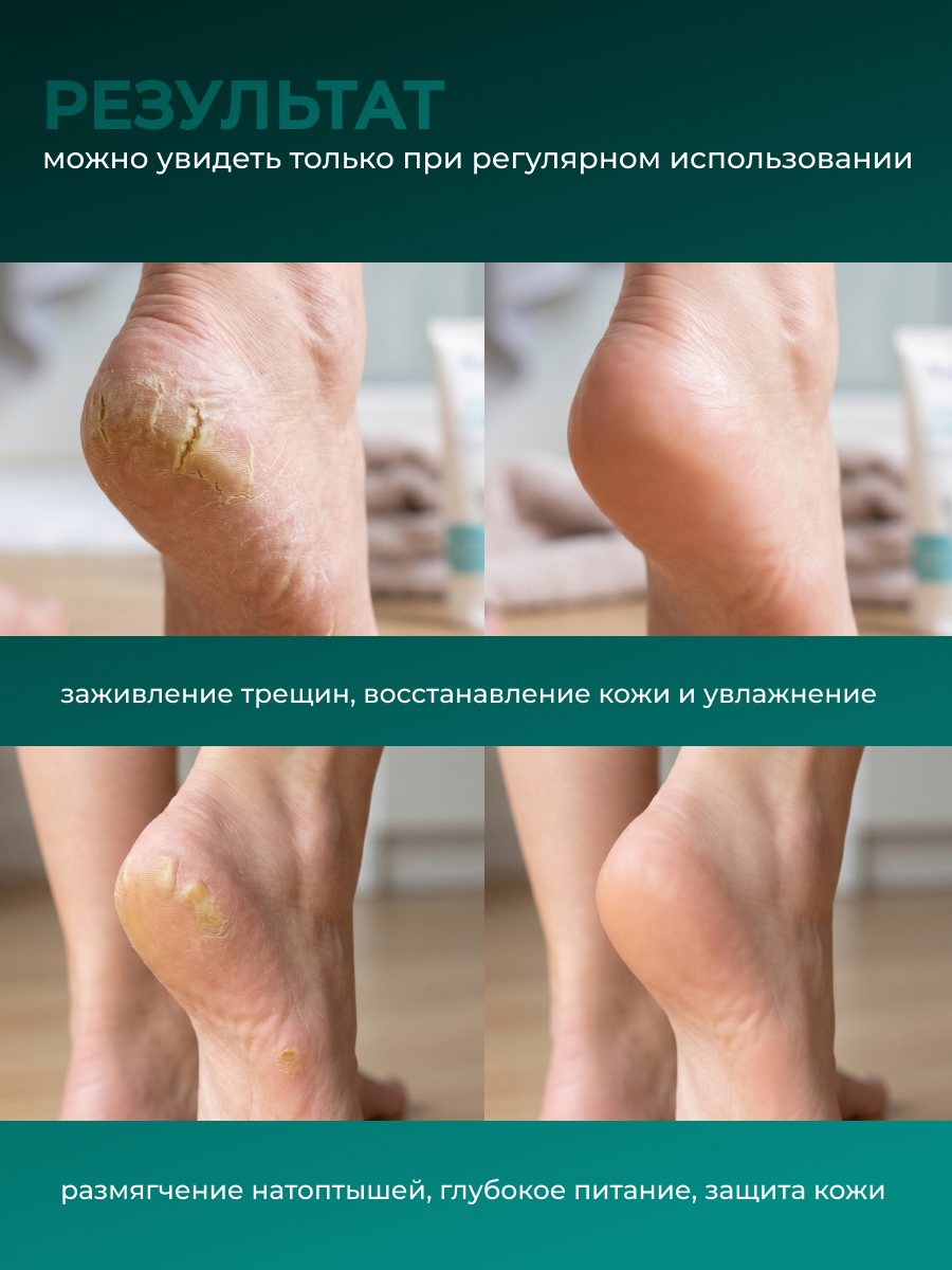 Manita Professional Крем для ног MENTOL + UREA 460 мл