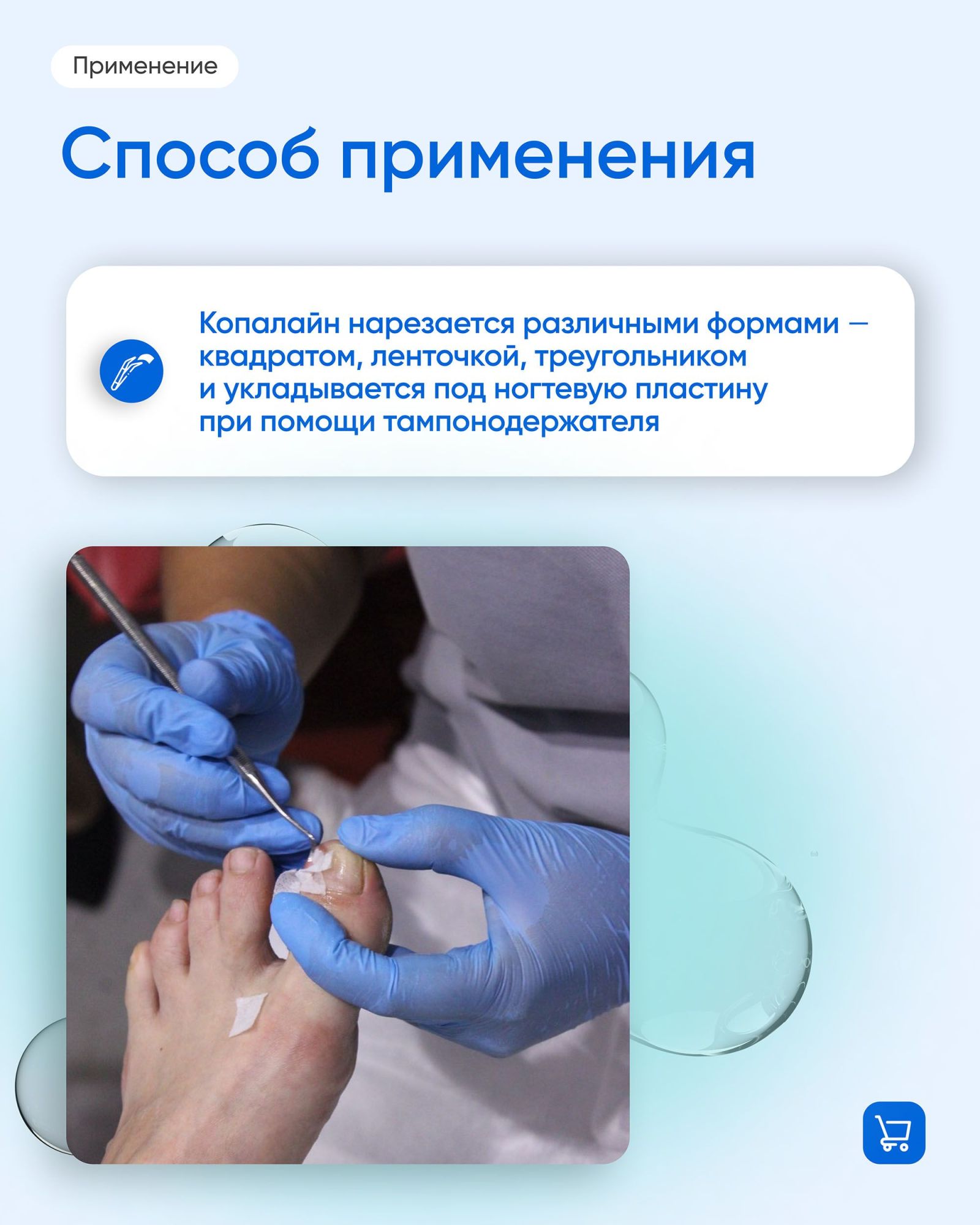 ВладМиВа "Копалайн" для ремонта ногтей (средней плотности), 1,4х10 м